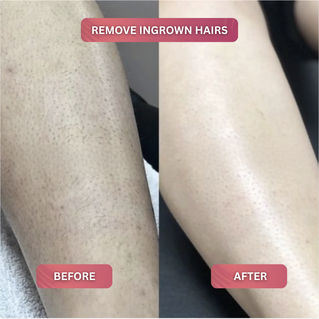 Cyperus Rotundus Skin Serum