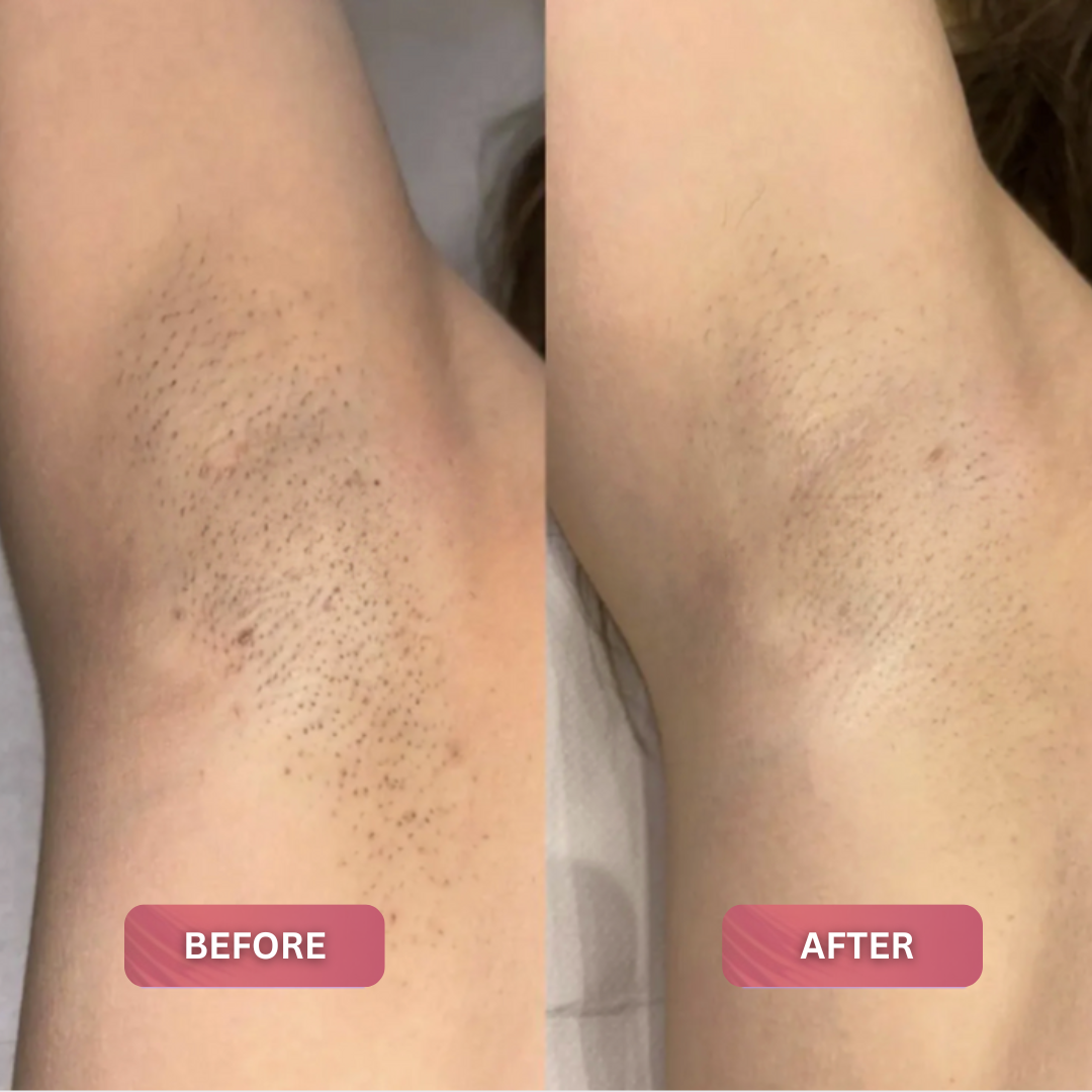 Cyperus Rotundus Oil