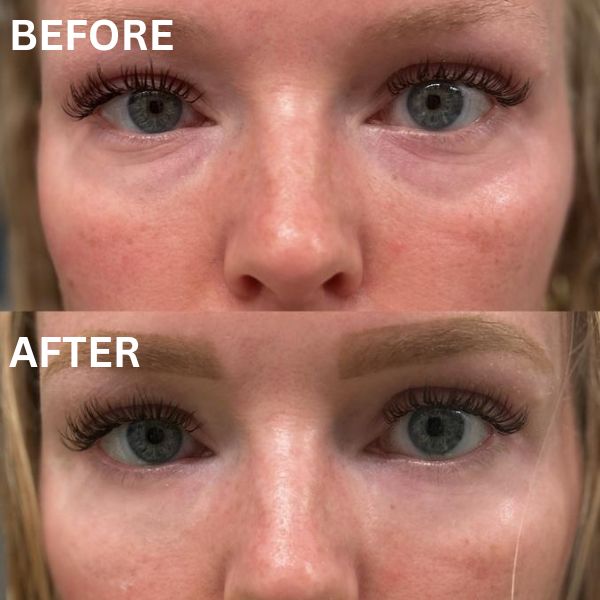 Collagen Eye Patches