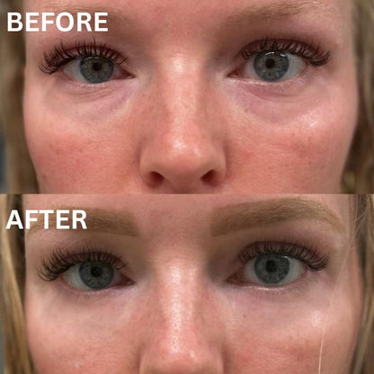 Collagen Eye Patches