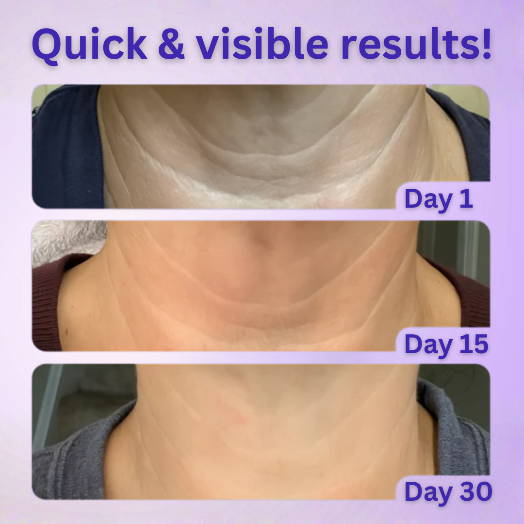 Neck Tightening Cream