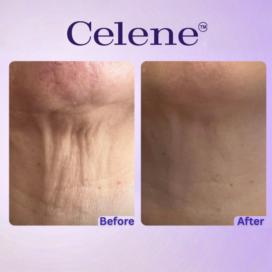 Neck Tightening Cream