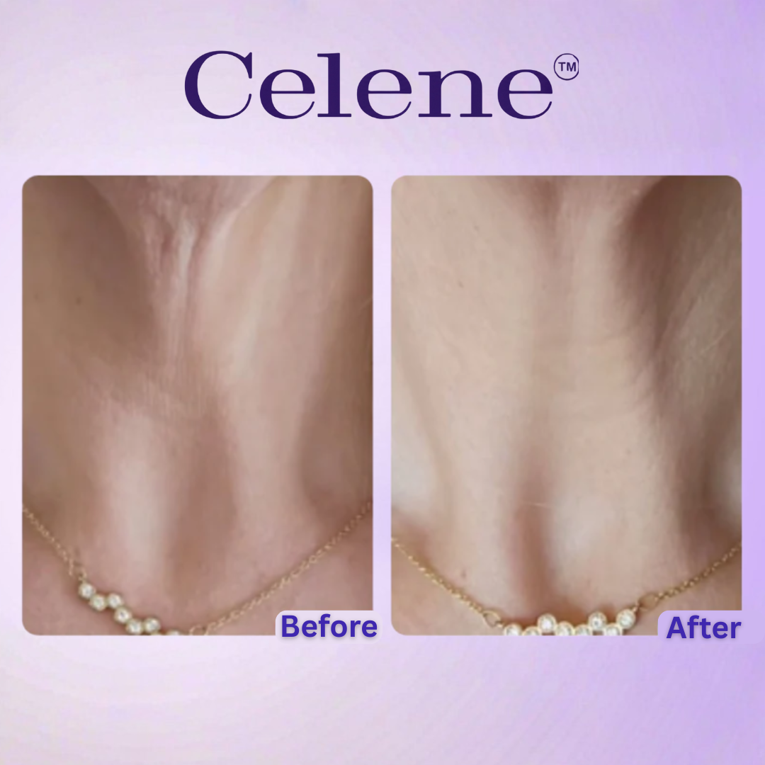 Neck Tightening Cream
